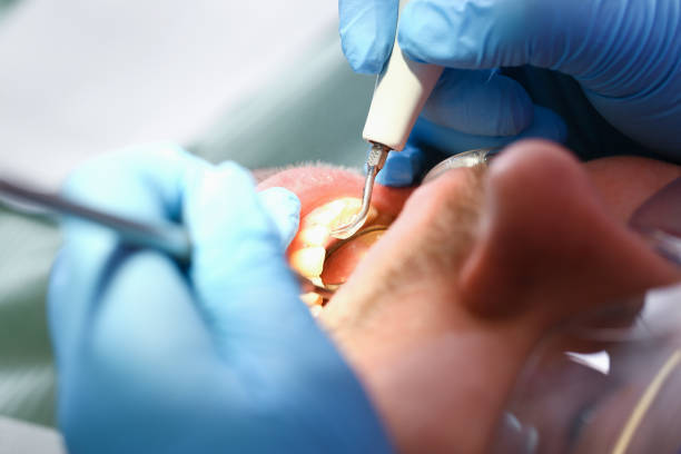 Best Pediatric Emergency Dentist in St Croix Falls, WI